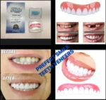 PERFECT SMILE VENEERS – REUSABLE TEETH WHITENING SILICONE TEETH UPPER COVER VENEERS