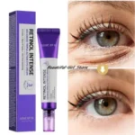 SOME BY MI RETINOL INTENSE ADVANCED TRIPPLE ACTION EYE CREAM (30ML) - Image 2