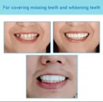 PERFECT SMILE VENEERS – REUSABLE TEETH WHITENING SILICONE TEETH UPPER COVER VENEERS - Image 4