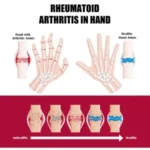 PERFECTX INTENSIVE CONCENTRATED JOINT & BONE THERAPY CREAM WITH COLLAGEN, VITAMIN, K2 & MSM – 50G - Image 6