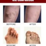 PERFECTX INTENSIVE CONCENTRATED JOINT & BONE THERAPY CREAM WITH COLLAGEN, VITAMIN, K2 & MSM – 50G - Image 7