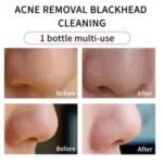 ORIGINAL SUDOCREM ANTISEPTIC HEALING CREAM FOR DIAPER RASH/ECZEMA/SURFACE BURN/SUNBURN & OTHERS SKIN BLEMISHES – 250G - Image 5