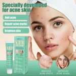 HBESTY ACNE REMOVER CREAM