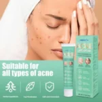 HBESTY ACNE REMOVER CREAM - Image 4