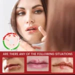 SUMIFUN COLD SORE RELIEF CREAM (20G) - Image 3