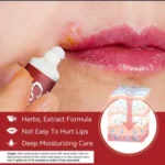 SUMIFUN COLD SORE RELIEF CREAM (20G) - Image 5