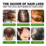 JASUING GINGER GERMINAL HAIR GROWTH TREATMENT SPRAY (120ML) - Image 3