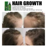 JASUING GINGER GERMINAL HAIR GROWTH TREATMENT SPRAY (120ML) - Image 8