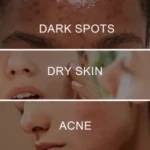 WEST&MONTH RETINOL PIGMENT CORRECTING SPRAY (SKIN PIGMENTATION CORRECTOR) – 30ML - Image 4