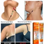 SOUTH MOON LYMPH NODES HERBAL DETOX CREAM – MASSAGE & ANTI SWELLING HERBS CREAM - Image 5